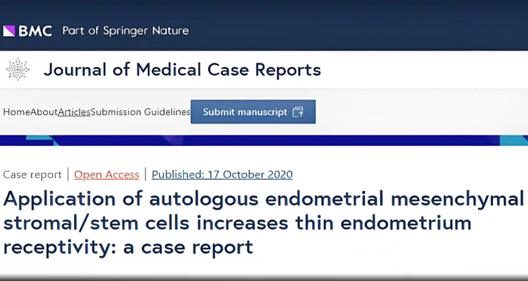 干細胞治療子宮內膜薄弱臨床研究進展
